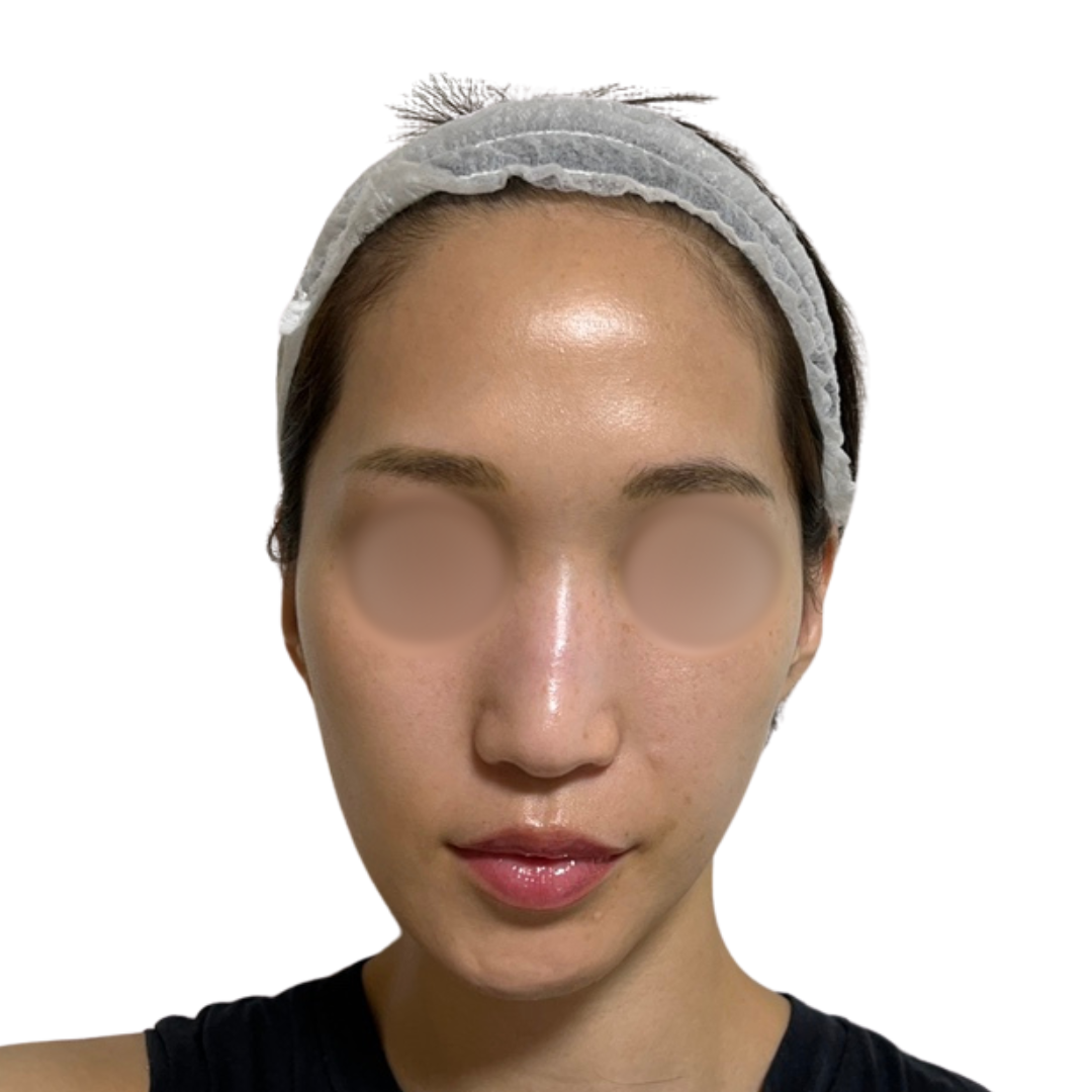 パーティーリフト（スマスアップネオ）